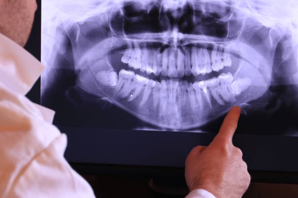 Best Mobile Emergency Dentist in Burlington, CO