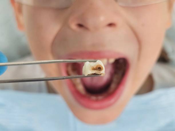 Best Mobile Emergency Dentist in Burlington, CO